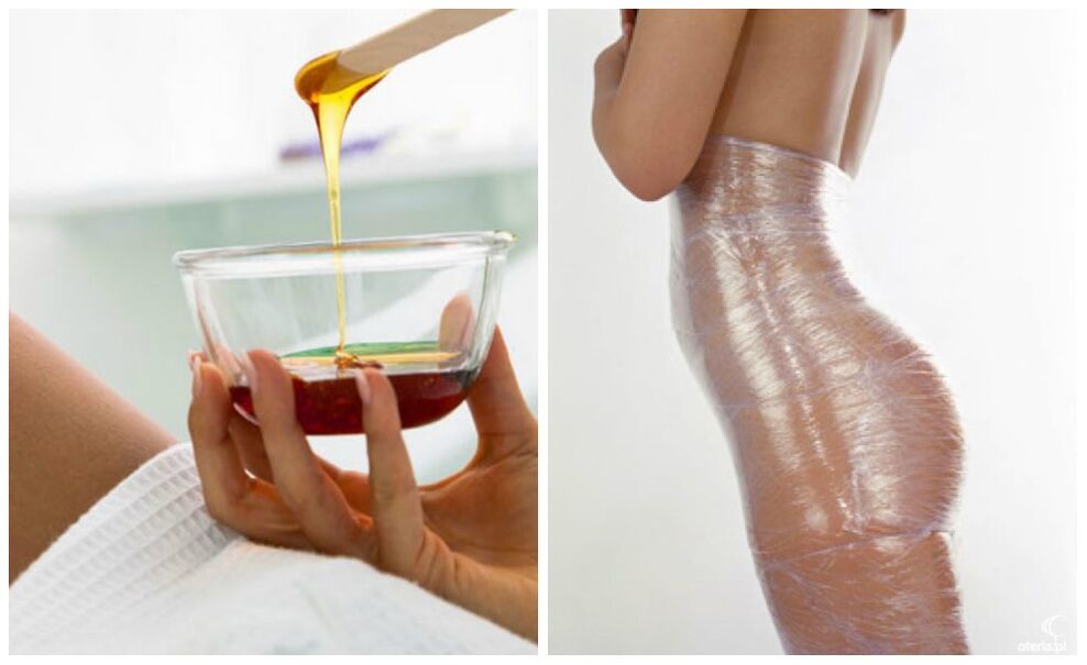 wraps comhlacht do meáchain caillteanas